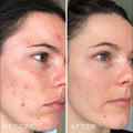 Dermatoria Retinol Shot™