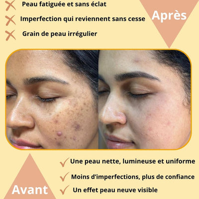Dermatoria Retinol Shot™